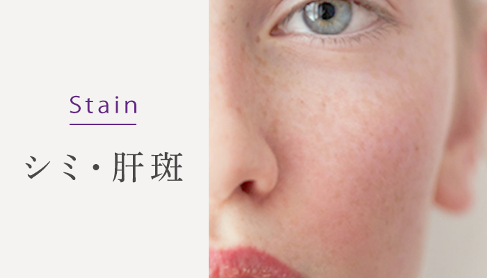 Stain シミ・肝斑