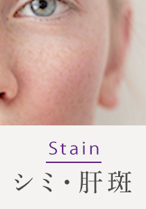 Stain シミ・肝斑