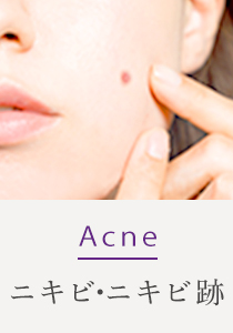 Acne ニキビ・ニキビ跡