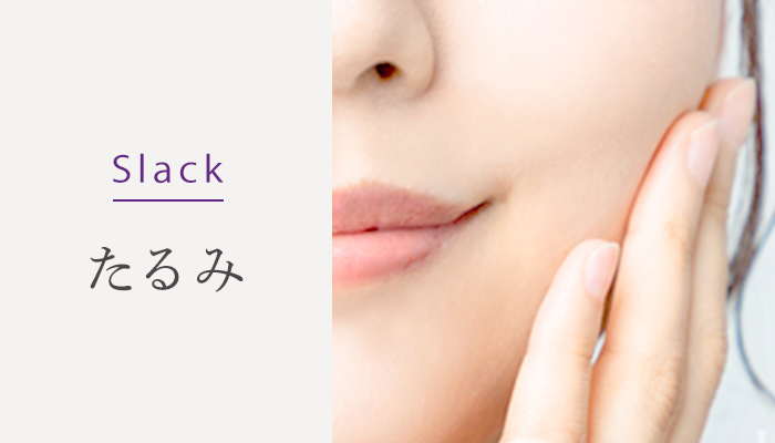 Slack たるみ