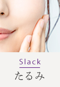 Slack たるみ