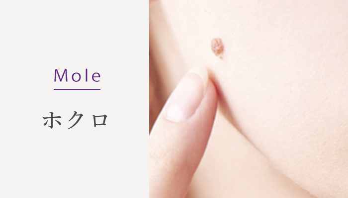 Mole ホクロ