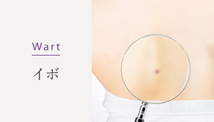 Wart イボ