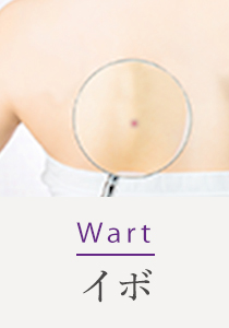 Wart イボ
