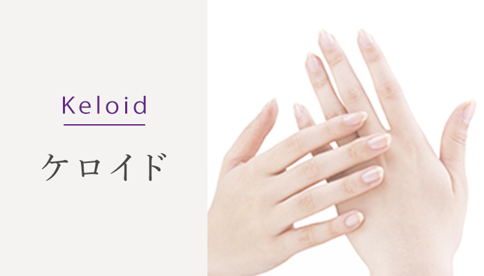 Keloid ケロイド