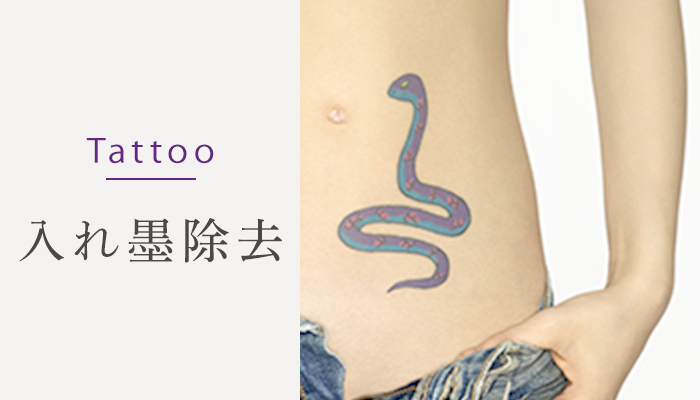 Tattoo 入れ墨除去