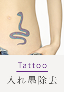 Tattoo 入れ墨除去